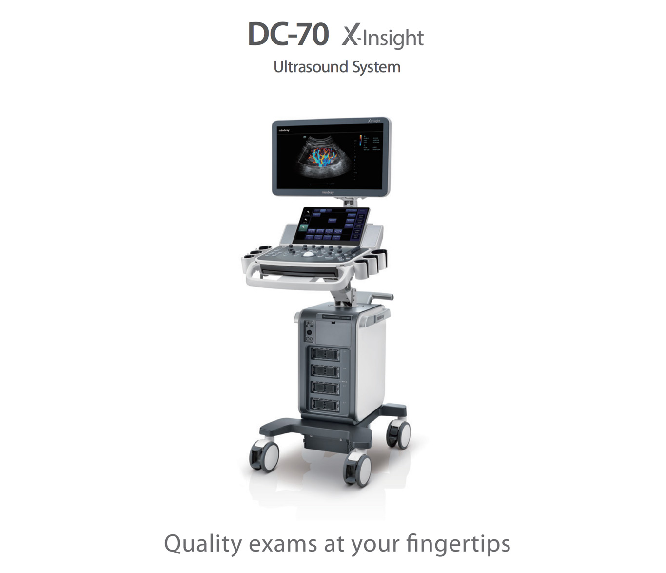 DC-70X Ultrasound System for Vein Practices